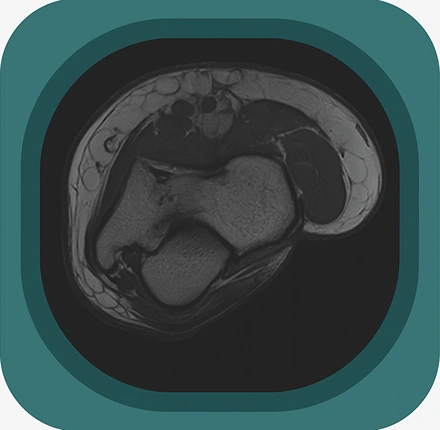 MRI elbow ligaments anatomy icon